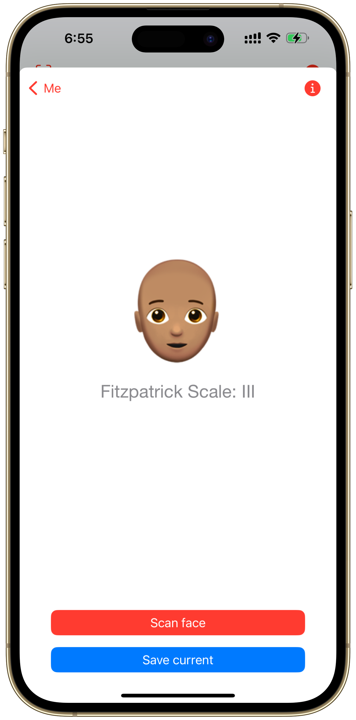 Fitzpatrick